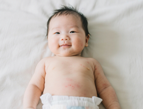 diapers rash.png